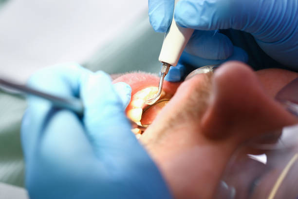 Best Emergency Dental Care for Broken or Chipped Teeth in Muhlenberg Rk, PA