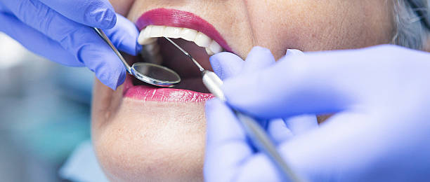 Best Emergency Root Canal Treatment in Muhlenberg Rk, PA