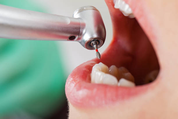 Best Emergency Treatment for Dental Infections or Abscesses in Muhlenberg Rk, PA
